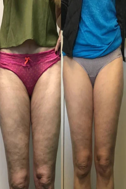 Vacutone Firm & Sculpt Pro™